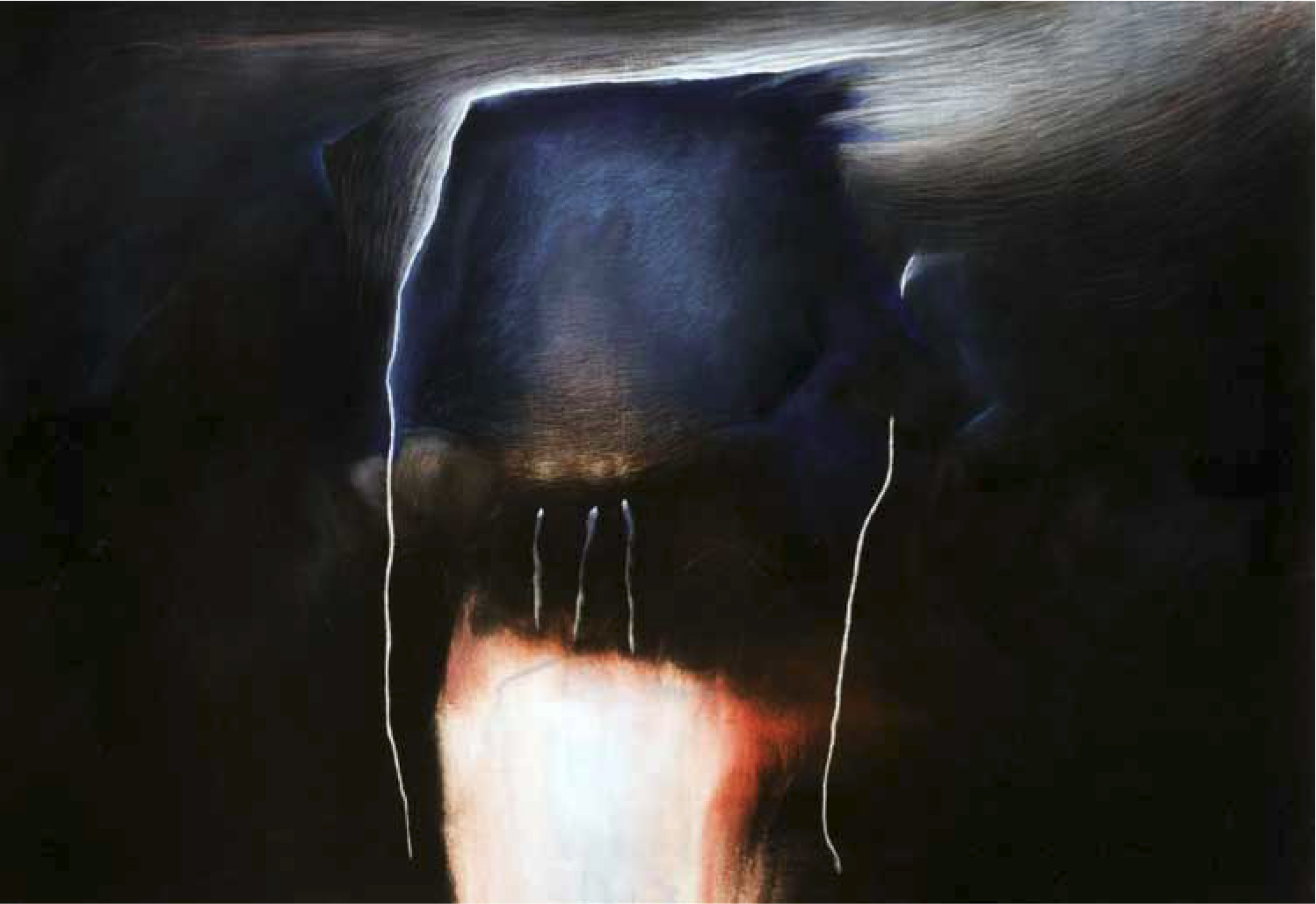 Corps et âme III